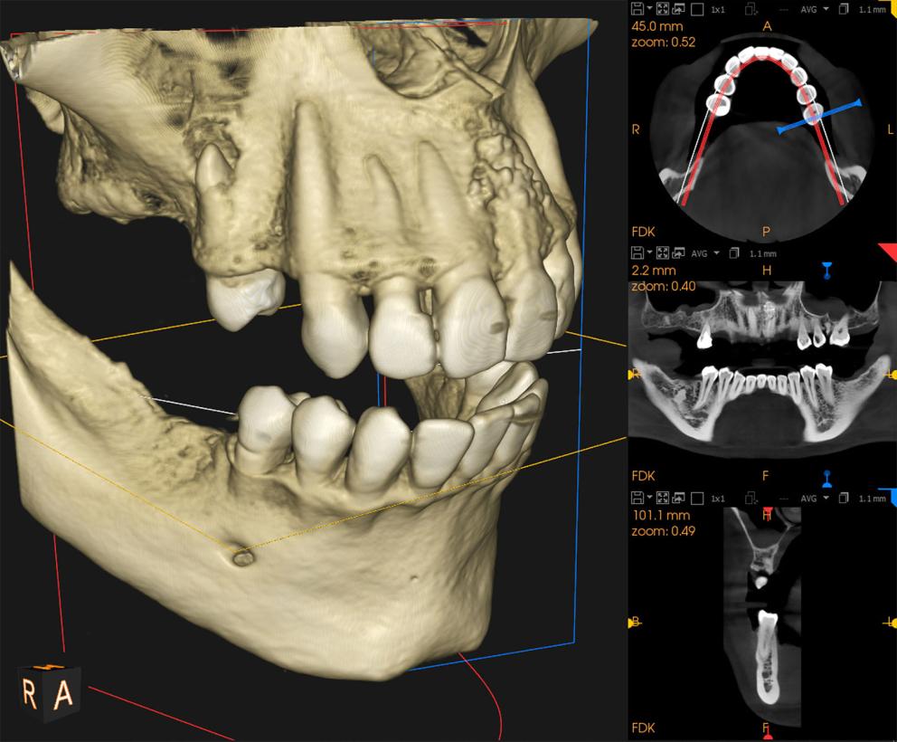Imagerie d'un examen CBCT
