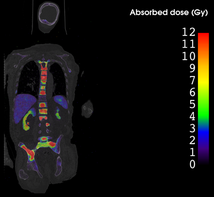 Radiothérapie, dose absorbée